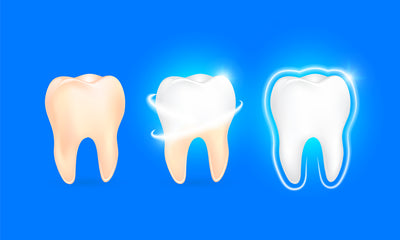What causes yellow teeth?