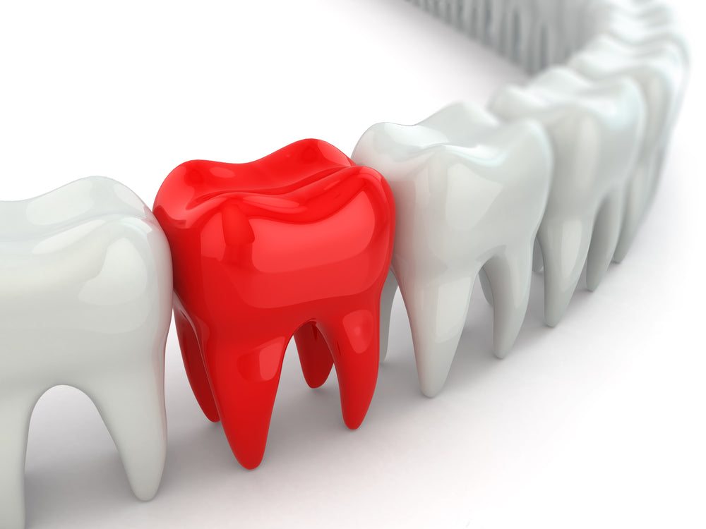 How to Whiten Your Teeth Without Harming Them?