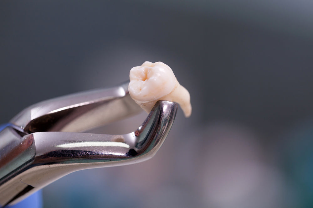 Teeth removal: Postoperative Care for Teeth